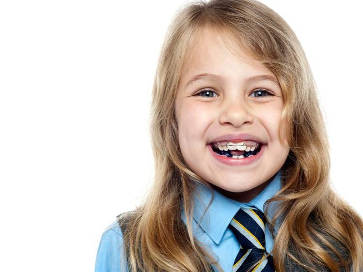 How To Fix Gaps In Teeth क्या हमेशा डायस्टेमा अपने आप भर जाता है